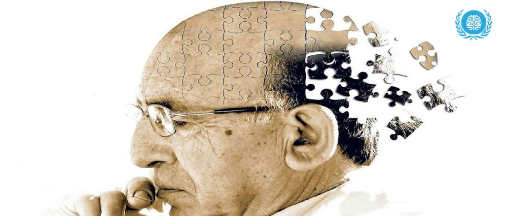 Memantine and Alzheimer's disease