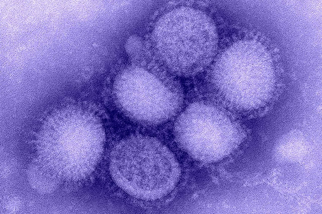 H1N1_influenza_virus、Flu、IRS19、シアノコバラミン、Actovegin購入
