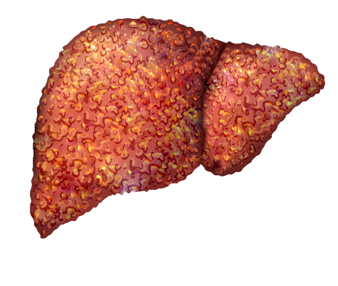 Heptral. B12. Cirrhosis of the liver.