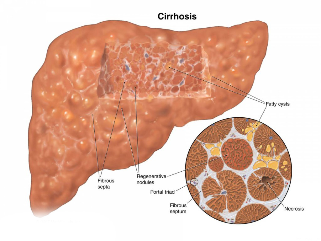 Heptral. hepatoprotectors